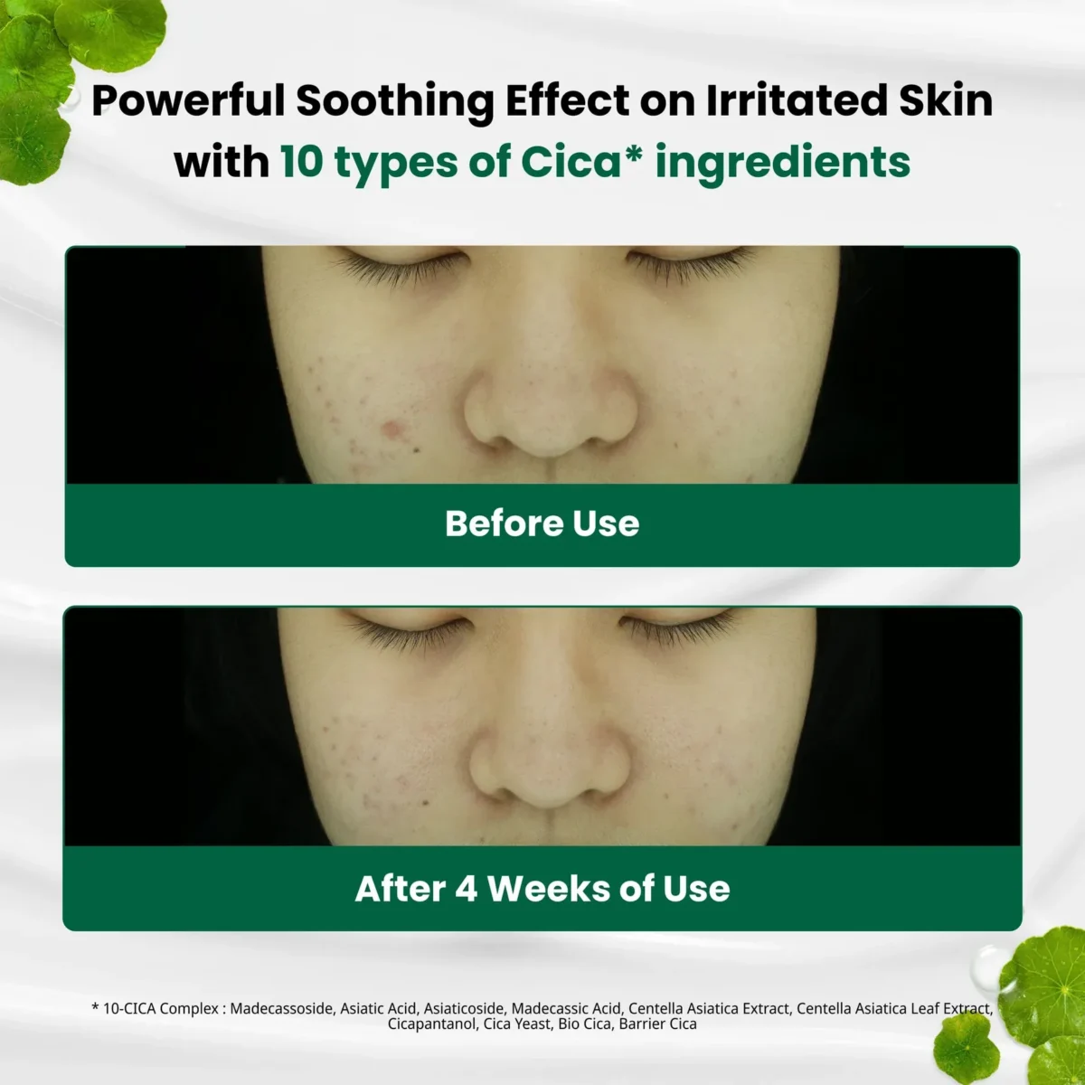 ⁦دكتور جي كريم جل مهدئ للاحمرار وعيوب البشرة (Dr.G R.E.D Blemish Clear Soothing Cream) - 70 مل⁩ - الصورة ⁦2⁩