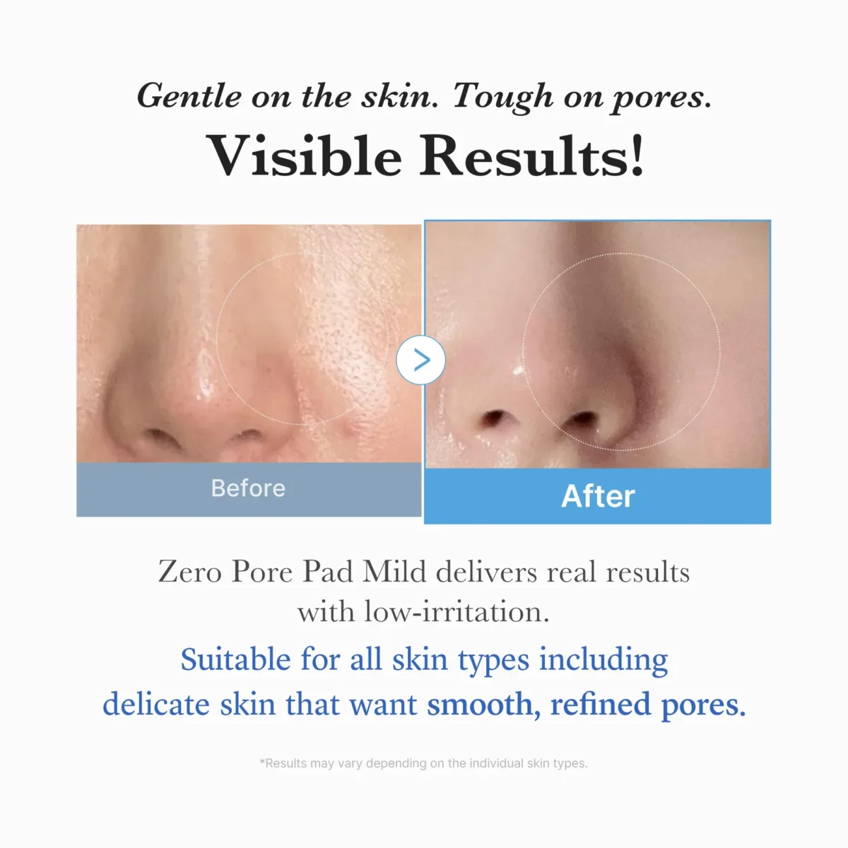 ⁦وسادات قطنية زيرو بور المعتدلة لتقليص المسام وتقشير البشرة من ميديكيوب (Medicube Zero Pore Pads Mild) -  70 وسادة⁩ - الصورة ⁦2⁩