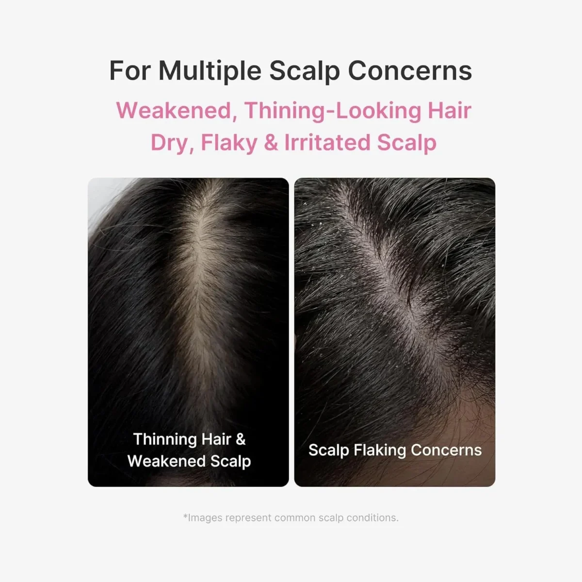 ⁦سيروم فروة الرأس روزماري بي دي آر إن لتقوية الشعر من ميديكيوب (Medicube Rosemary PDRN Scalp Serum) - 20 مل⁩ - الصورة ⁦2⁩