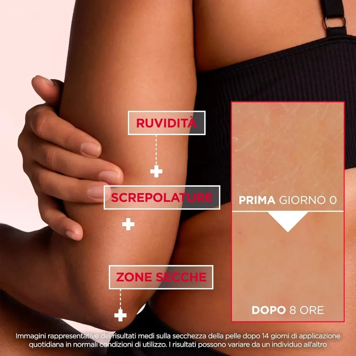 ⁦كريم الجسم يوريا سيكا لتجديد البشرة بتركيز 10% يوريا وأحماض أمينية من ميكسا (Mixa Urea Cica Repair Body Lotion 10% Urea & Amino Acids) - 400 مل⁩ - الصورة ⁦2⁩