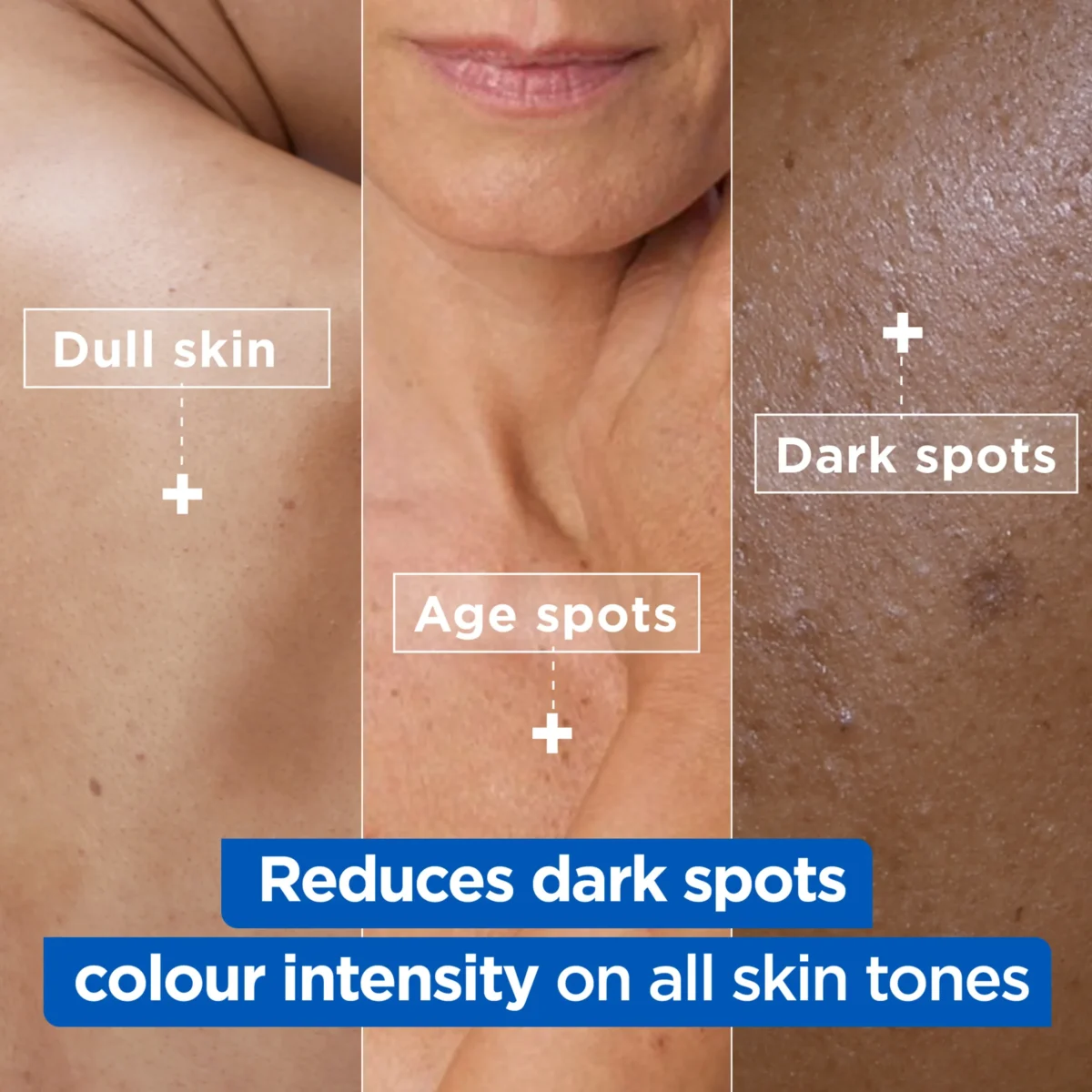 ⁦كريم نياسيناميد برايت لتفتيح وتوحيد لون الجسم من ميكسا (Mixa Niacinamide Bright Body Cream) - 400 مل⁩ - الصورة ⁦2⁩
