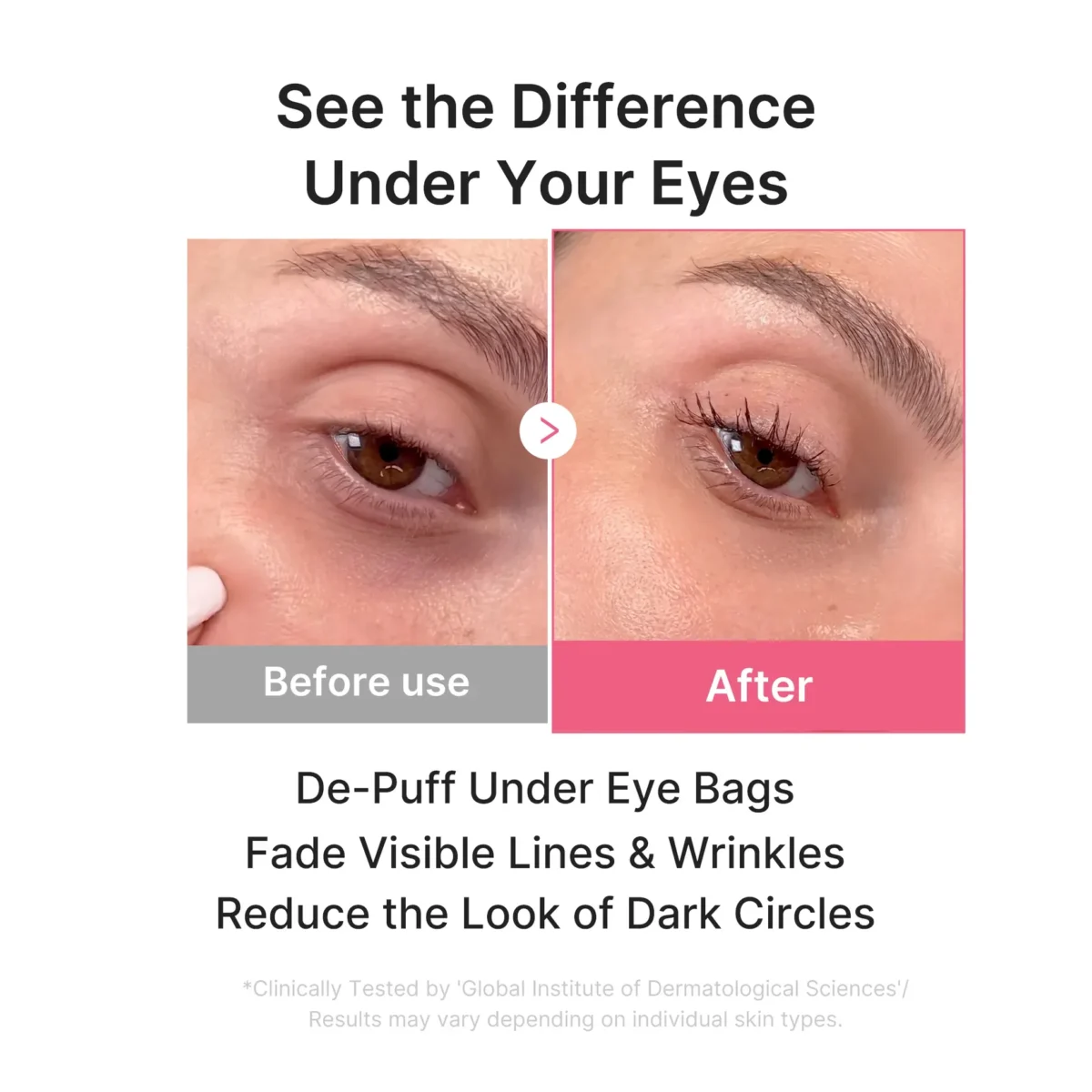 ⁦لصقات الكولاجين للعين بتقنية PDRN من ميديكيوب (Medicube PDRN Pink Collagen Jelly Eye Mask) - زوج واحد⁩ - الصورة ⁦2⁩
