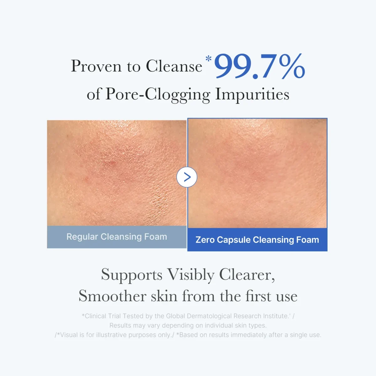 ⁦غسول كبسولات زيرو بور الأزرق لتنظيف المسام العميق من ميديكيوب (Medicube Zero Pore Capsule Cleansing Foam) - 120 مل⁩ - الصورة ⁦4⁩
