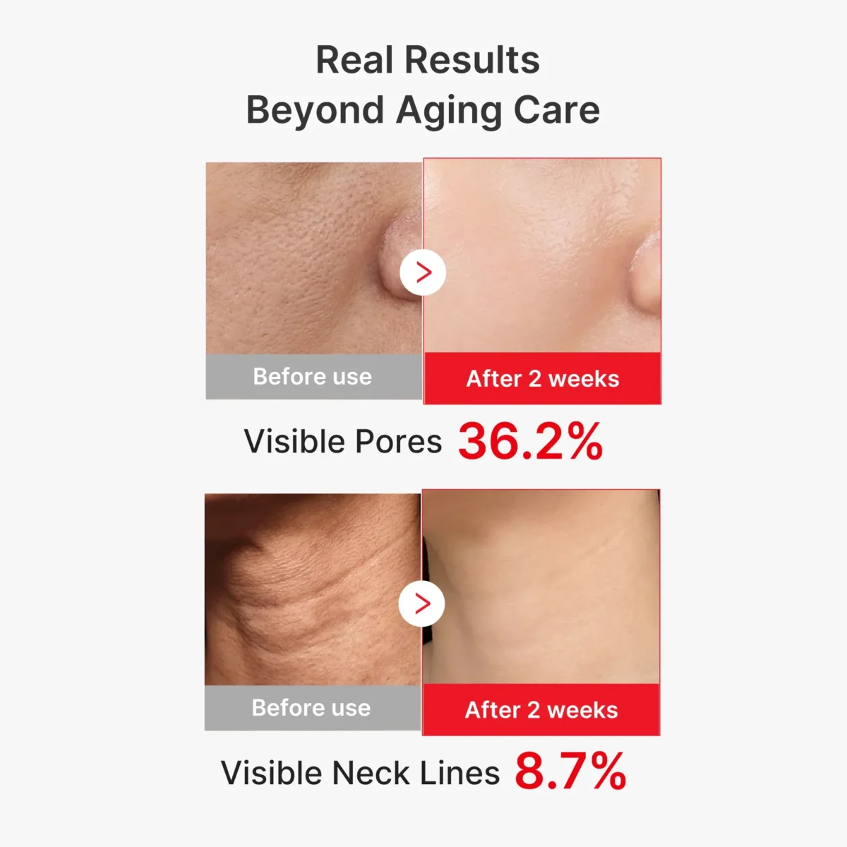 ⁦سيروم شد البشرة ومكافحة التجاعيد بتقنية EGF من ميديكيوب (Medicube EGF NAD+ Firming Serum) - 30 مل⁩ - الصورة ⁦2⁩
