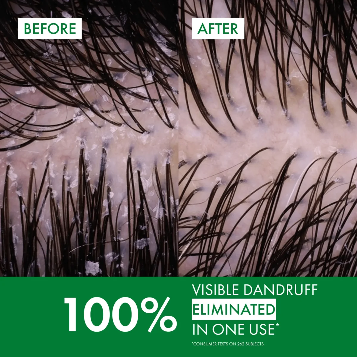 ⁦شامبو فيشي ديركوس المضاد للقشرة للشعر الجاف (Vichy Dercos Anti-Dandruff Shampoo for Dry Hair) - 200 مل⁩ - الصورة ⁦2⁩